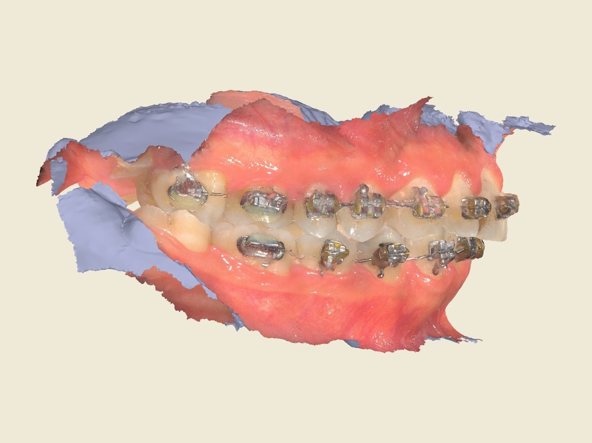 Lateral derecha