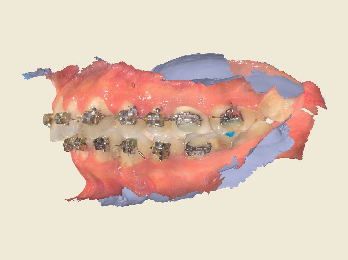 Lateral izquierda