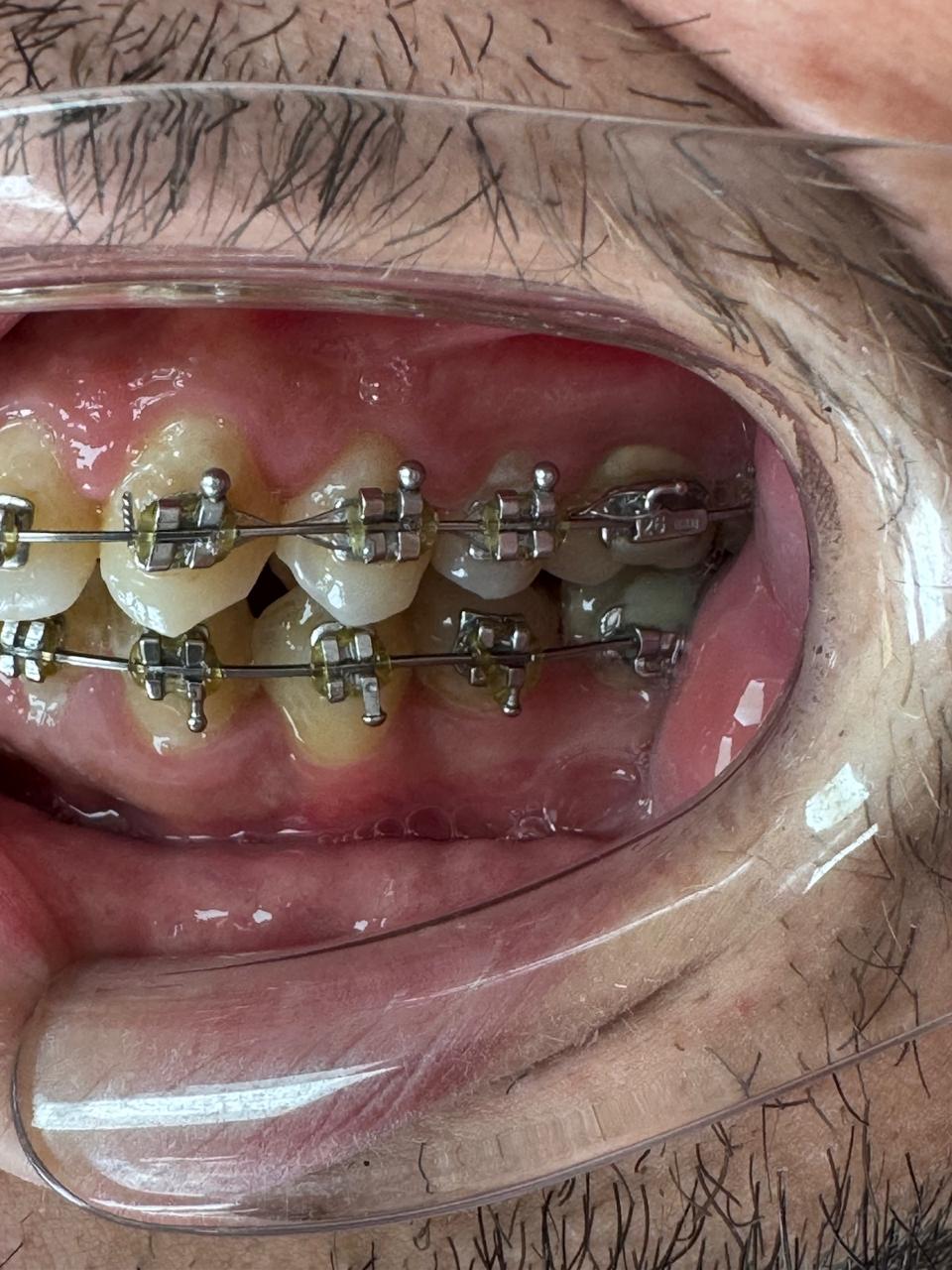Lateral izquierda